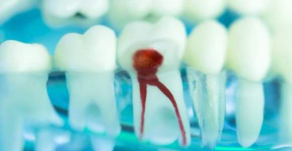 根管治療實(shí)現(xiàn)可視化操作