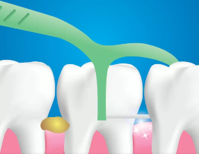 口腔問題可能要“命”！5大預(yù)警信號(hào)，別忽視